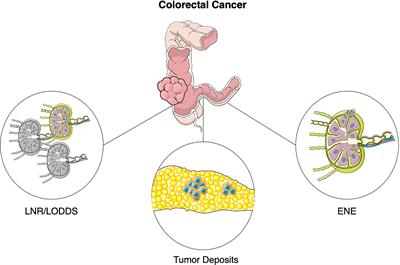 Beyond N staging in colorectal cancer: Current approaches and future perspectives